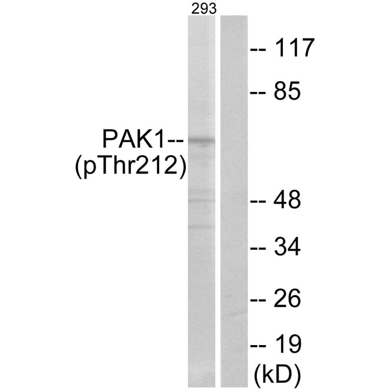 Western Blot - Anti-PAK1 (phospho Thr212) Antibody (A0539) - Antibodies.com