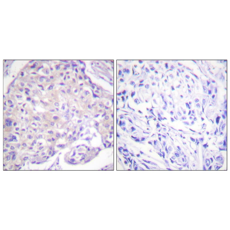 Immunohistochemistry - Anti-PAK1 (phospho Thr212) Antibody (A0539) - Antibodies.com