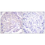 Immunohistochemistry - Anti-PAK1 (phospho Thr212) Antibody (A0539) - Antibodies.com