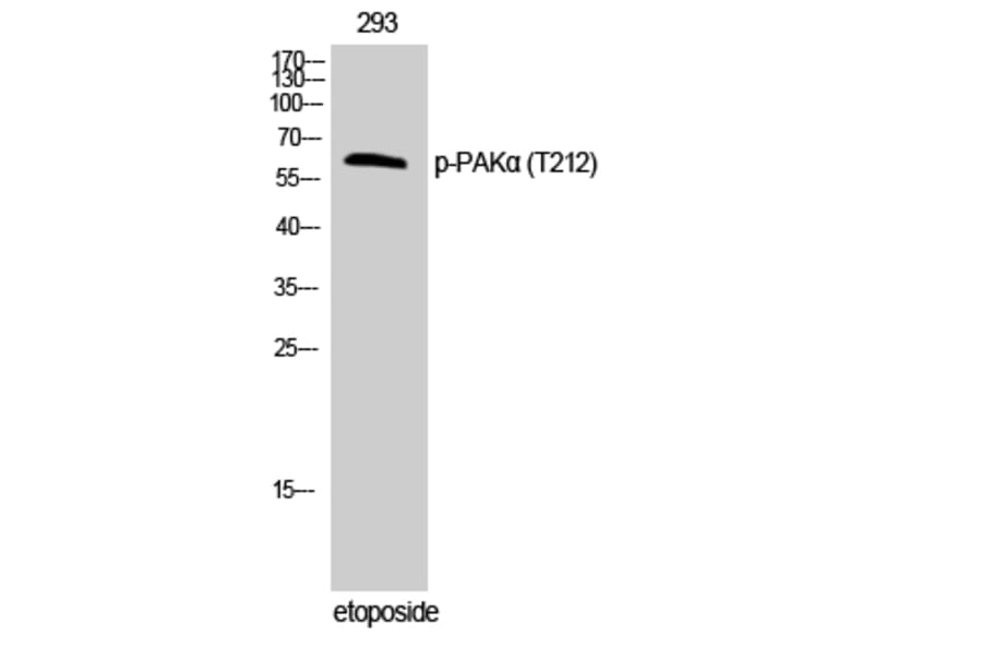 Western Blot - Anti-PAK1 (phospho Thr212) Antibody (A0539) - Antibodies.com