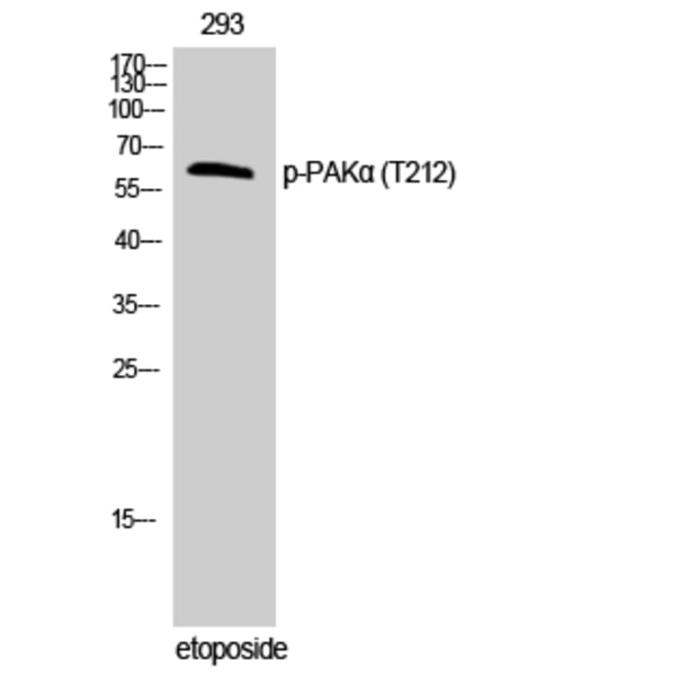 Western Blot - Anti-PAK1 (phospho Thr212) Antibody (A0539) - Antibodies.com