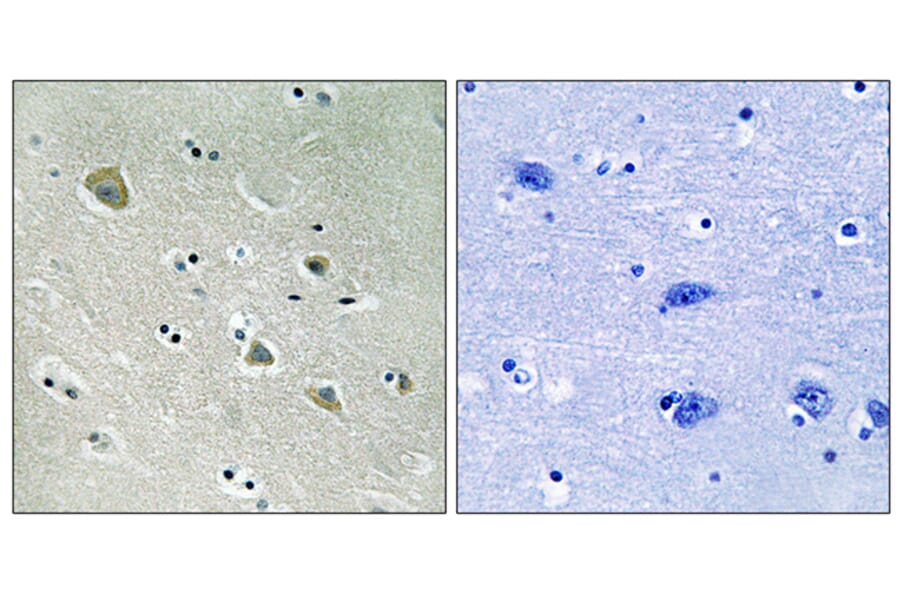 Immunohistochemistry - Anti-PAK1 (phospho Ser204) Antibody (A8158) - Antibodies.com
