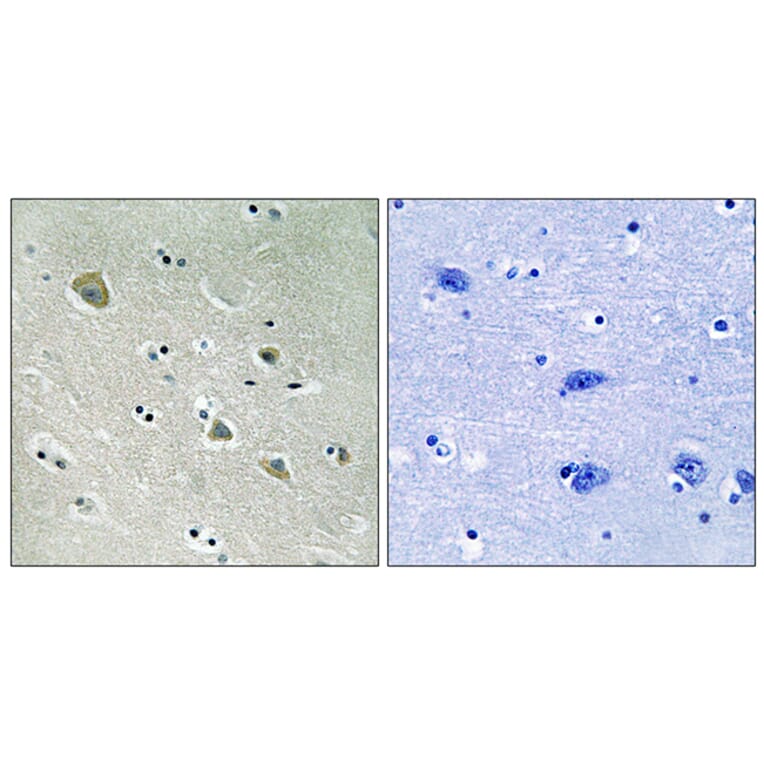 Immunohistochemistry - Anti-PAK1 (phospho Ser204) Antibody (A8158) - Antibodies.com