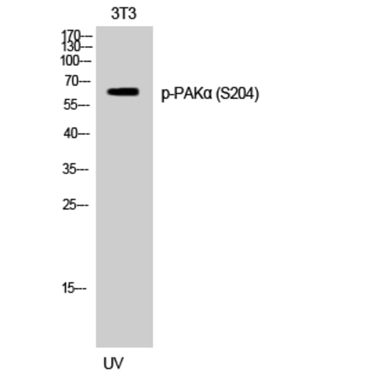 Western Blot - Anti-PAK1 (phospho Ser204) Antibody (A8158) - Antibodies.com