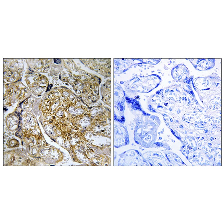 Immunohistochemistry - Anti-PAK1 (phospho Ser199) Antibody (A1113) - Antibodies.com