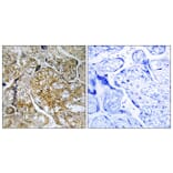 Immunohistochemistry - Anti-PAK1 (phospho Ser199) Antibody (A1113) - Antibodies.com