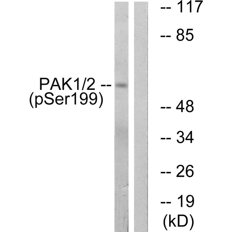 Western Blot - Anti-PAK1 (phospho Ser199) Antibody (A1113) - Antibodies.com