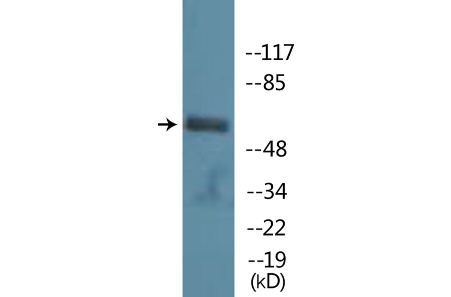 Western Blot - Anti-PAK1 (phospho Ser199) Antibody (P12-1161) - Antibodies.com