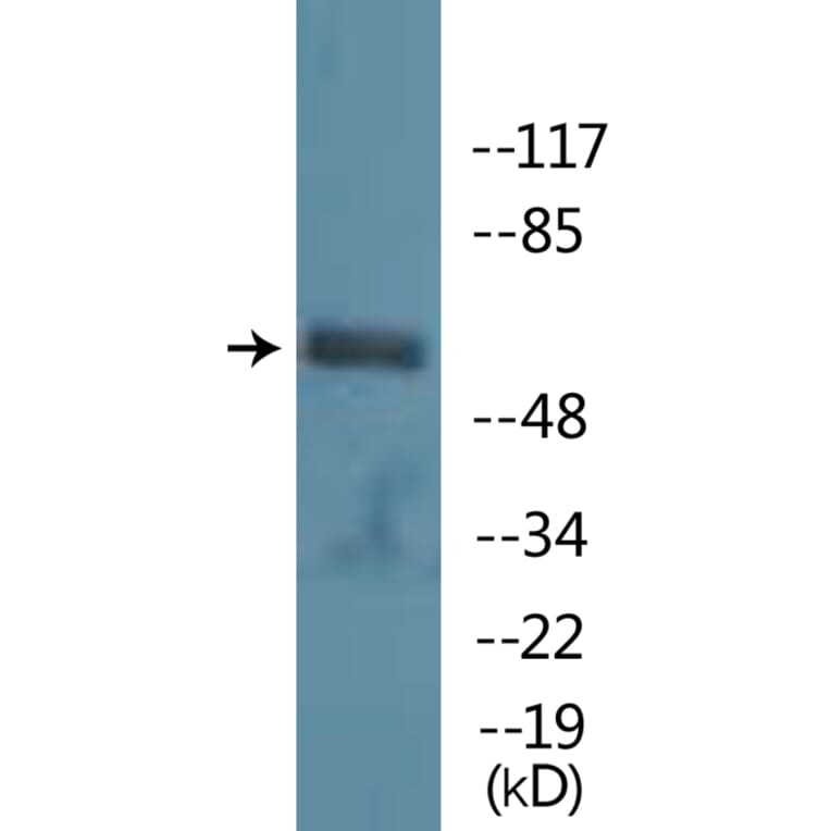 Western Blot - Anti-PAK1 (phospho Ser199) Antibody (P12-1161) - Antibodies.com