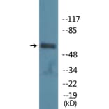 Western Blot - Anti-PAK1 (phospho Ser199) Antibody (P12-1161) - Antibodies.com