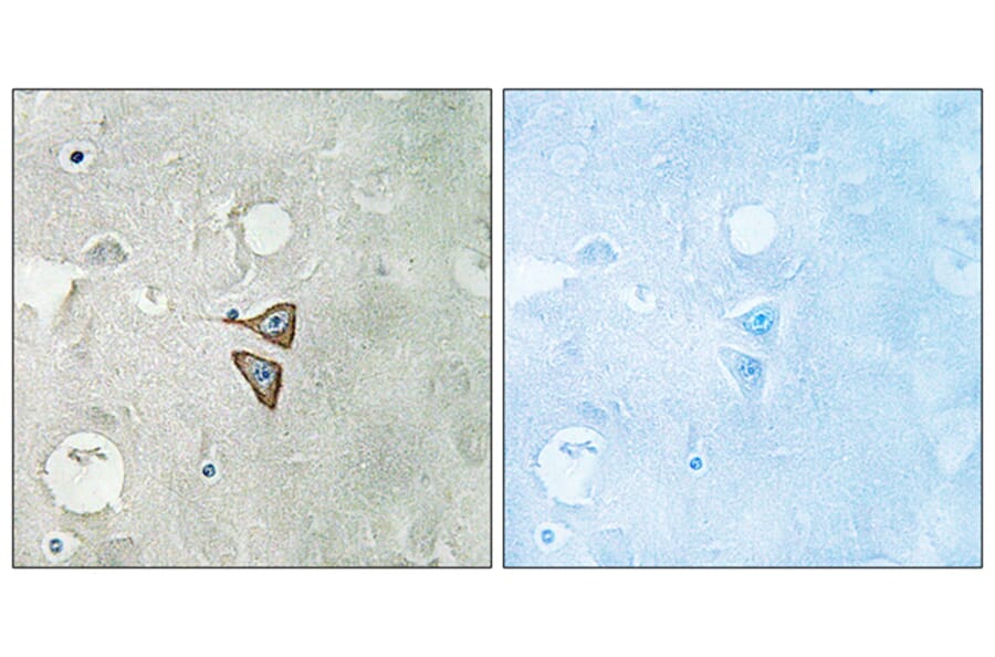 Immunohistochemistry - Anti-Opioid Receptor-delta Antibody (B0420) - Antibodies.com