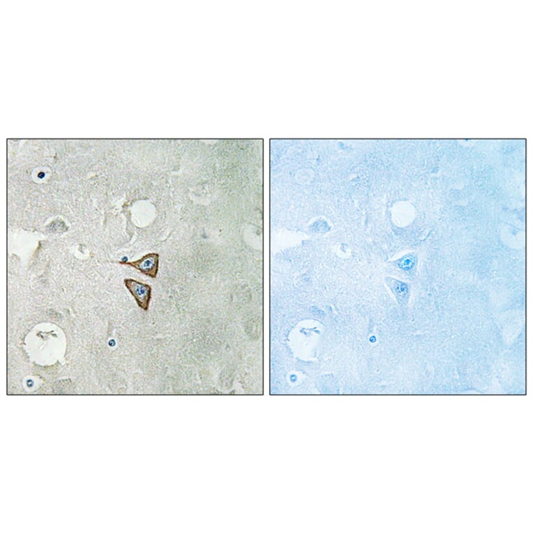 Immunohistochemistry - Anti-Opioid Receptor-delta Antibody (B0420) - Antibodies.com