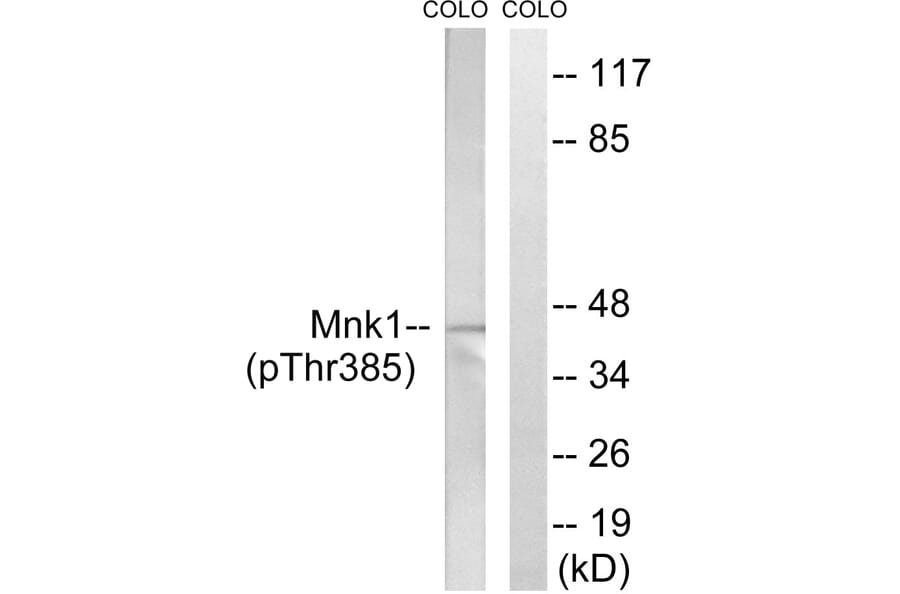 Western Blot - Anti-Mnk1 (phospho Thr385) Antibody (A8376) - Antibodies.com