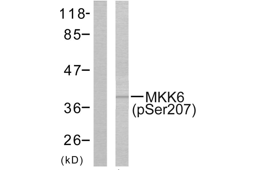 Western Blot - Anti-MKK6 (phospho Ser207) Antibody (A7154) - Antibodies.com
