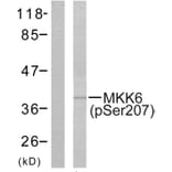 Western Blot - Anti-MKK6 (phospho Ser207) Antibody (A7154) - Antibodies.com