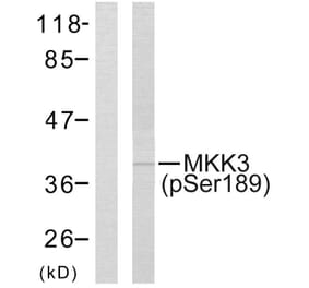 Western Blot - Anti-MKK3 (phospho Ser189) Antibody (A7153) - Antibodies.com