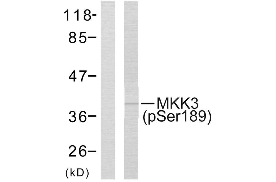 Western Blot - Anti-MKK3 (phospho Ser189) Antibody (A7153) - Antibodies.com