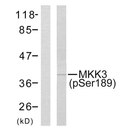 Western Blot - Anti-MKK3 (phospho Ser189) Antibody (A7153) - Antibodies.com