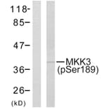 Western Blot - Anti-MKK3 (phospho Ser189) Antibody (A7153) - Antibodies.com
