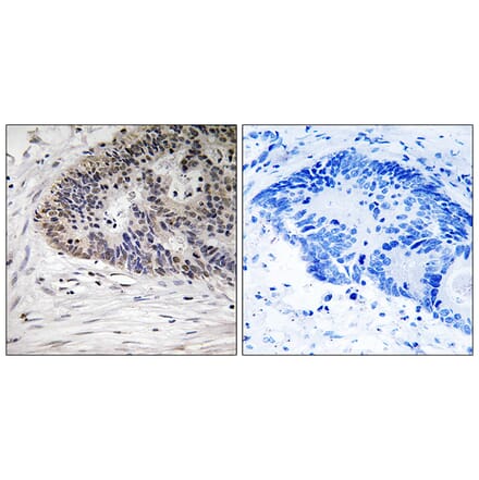 Immunohistochemistry - Anti-MDM4 (phospho Ser367) Antibody (A8369) - Antibodies.com