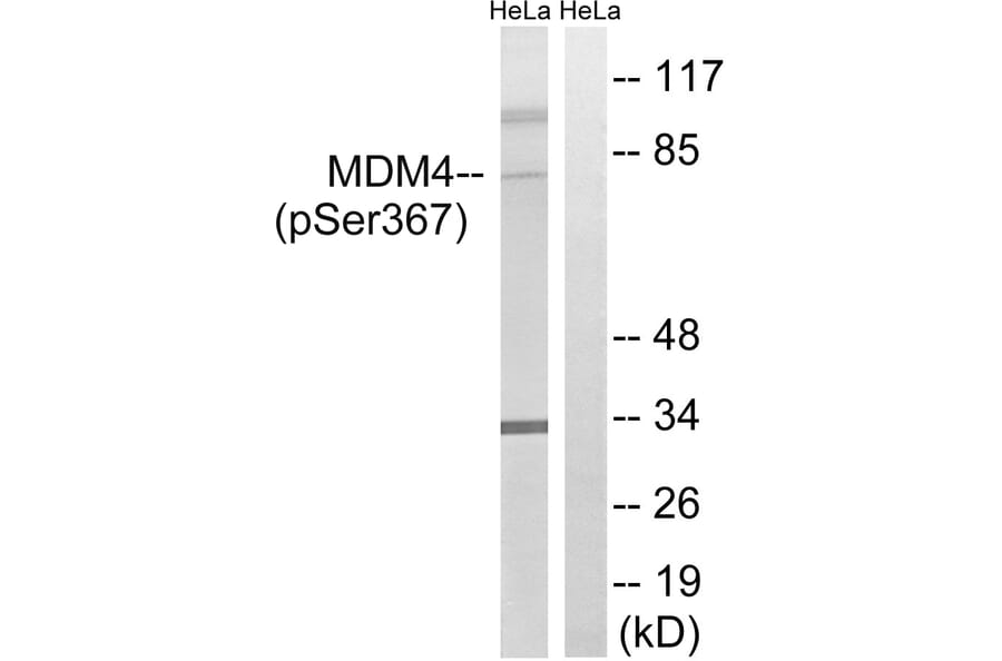 Western Blot - Anti-MDM4 (phospho Ser367) Antibody (A8369) - Antibodies.com