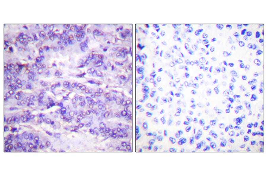 Immunohistochemistry - Anti-MDM2 (phospho Ser166) Antibody (A0508) - Antibodies.com
