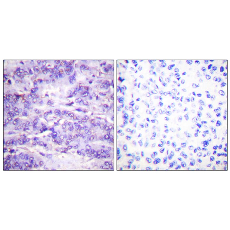 Immunohistochemistry - Anti-MDM2 (phospho Ser166) Antibody (A0508) - Antibodies.com