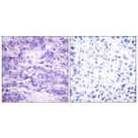 Immunohistochemistry - Anti-MDM2 (phospho Ser166) Antibody (A0508) - Antibodies.com