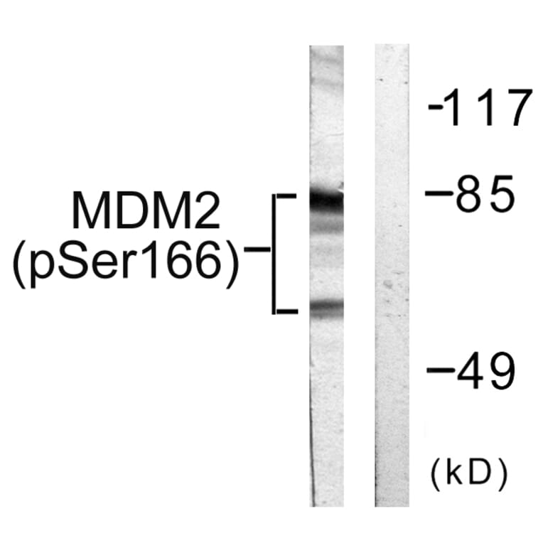 Western Blot - Anti-MDM2 (phospho Ser166) Antibody (A0508) - Antibodies.com