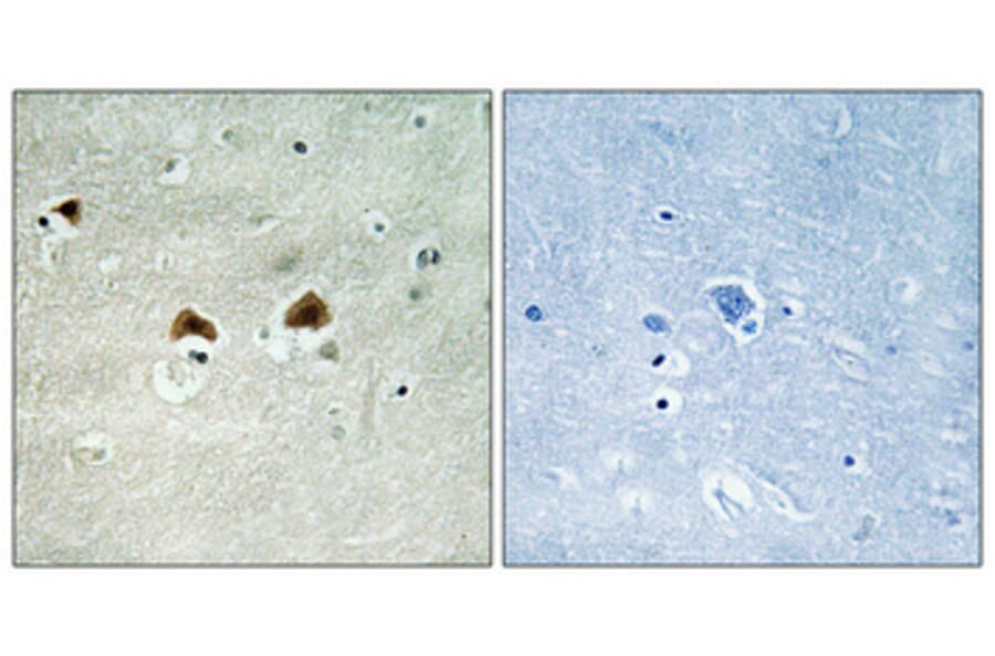 Immunohistochemistry - Anti-MAP4 (phospho Ser696) Antibody (A1092) - Antibodies.com