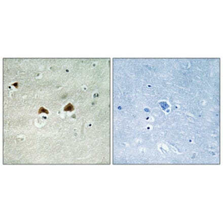 Immunohistochemistry - Anti-MAP4 (phospho Ser696) Antibody (A1092) - Antibodies.com