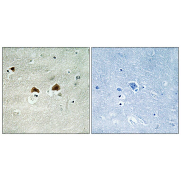 Immunohistochemistry - Anti-MAP4 (phospho Ser696) Antibody (A1092) - Antibodies.com
