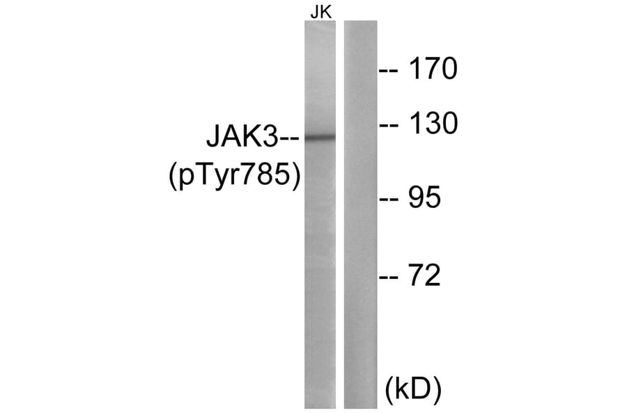 Western Blot - Anti-JAK3 (phospho Tyr785) Antibody (A1080) - Antibodies.com