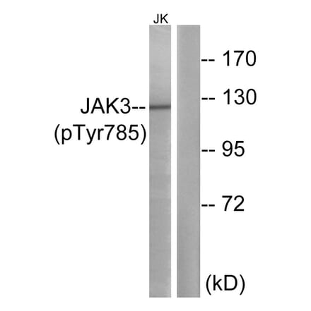 Western Blot - Anti-JAK3 (phospho Tyr785) Antibody (A1080) - Antibodies.com