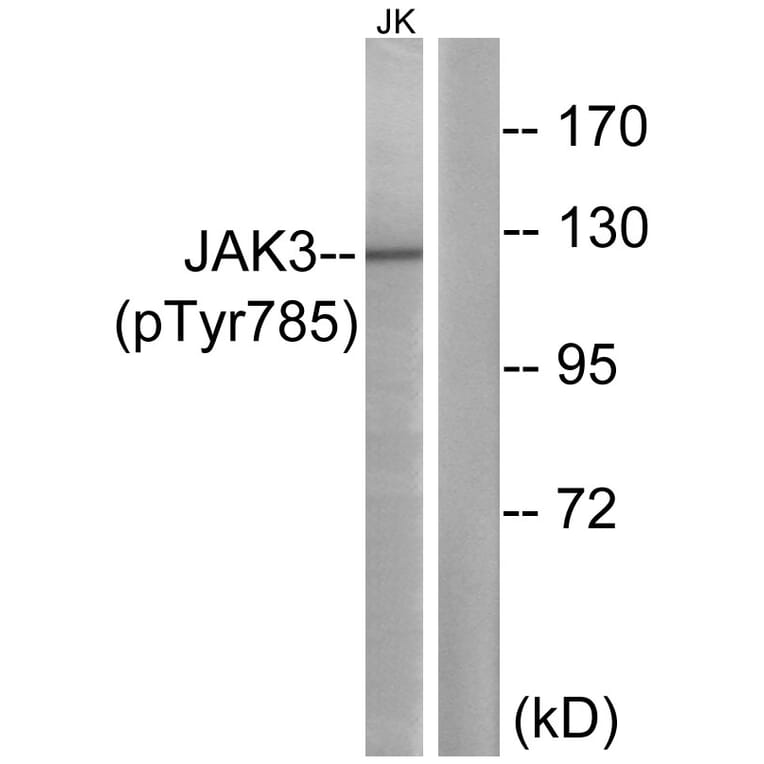 Western Blot - Anti-JAK3 (phospho Tyr785) Antibody (A1080) - Antibodies.com