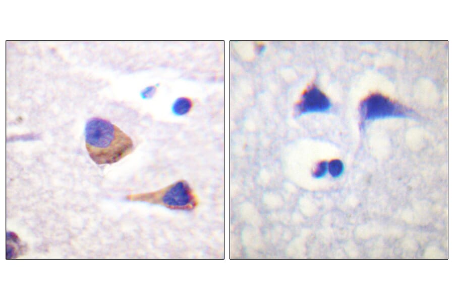 Immunohistochemistry - Anti-JAK3 (phospho Tyr785) Antibody (A1080) - Antibodies.com