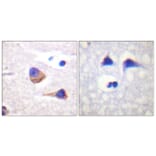 Immunohistochemistry - Anti-JAK3 (phospho Tyr785) Antibody (A1080) - Antibodies.com