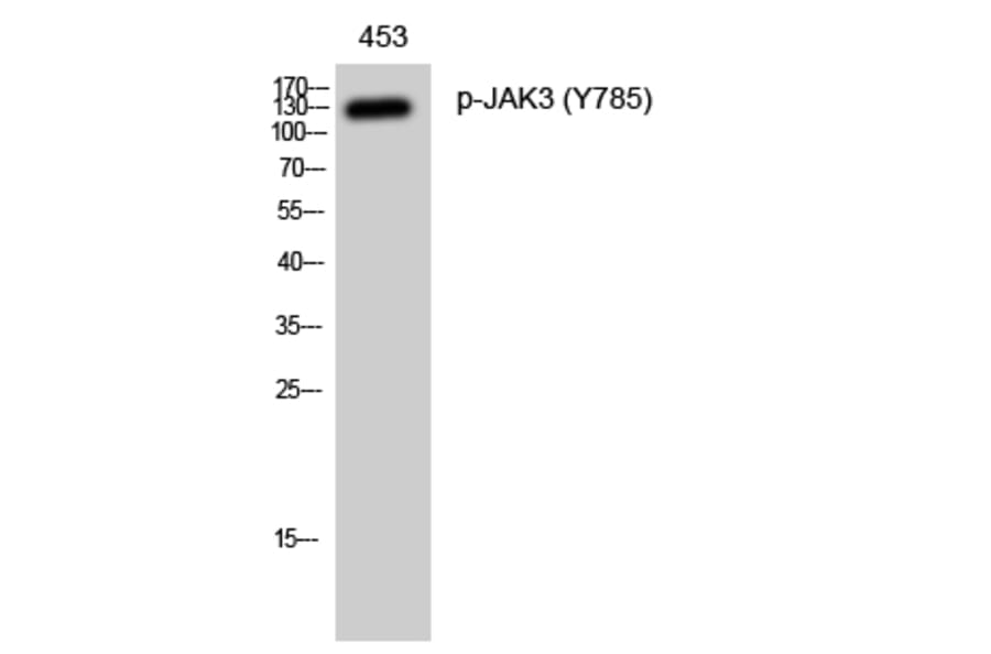 Western Blot - Anti-JAK3 (phospho Tyr785) Antibody (A1080) - Antibodies.com