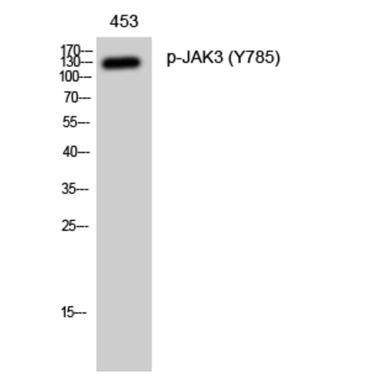 Western Blot - Anti-JAK3 (phospho Tyr785) Antibody (A1080) - Antibodies.com