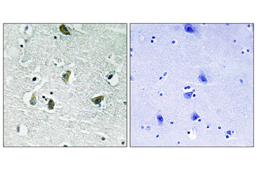 Immunohistochemistry - Anti-JAK2 (phospho Tyr931) Antibody (A8118) - Antibodies.com