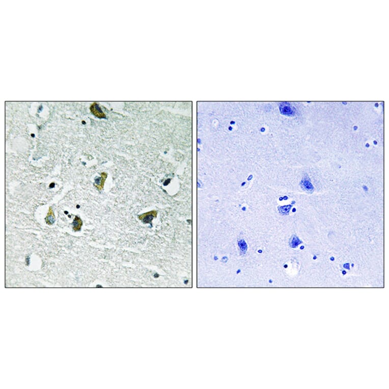 Immunohistochemistry - Anti-JAK2 (phospho Tyr931) Antibody (A8118) - Antibodies.com