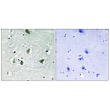 Immunohistochemistry - Anti-JAK2 (phospho Tyr931) Antibody (A8118) - Antibodies.com