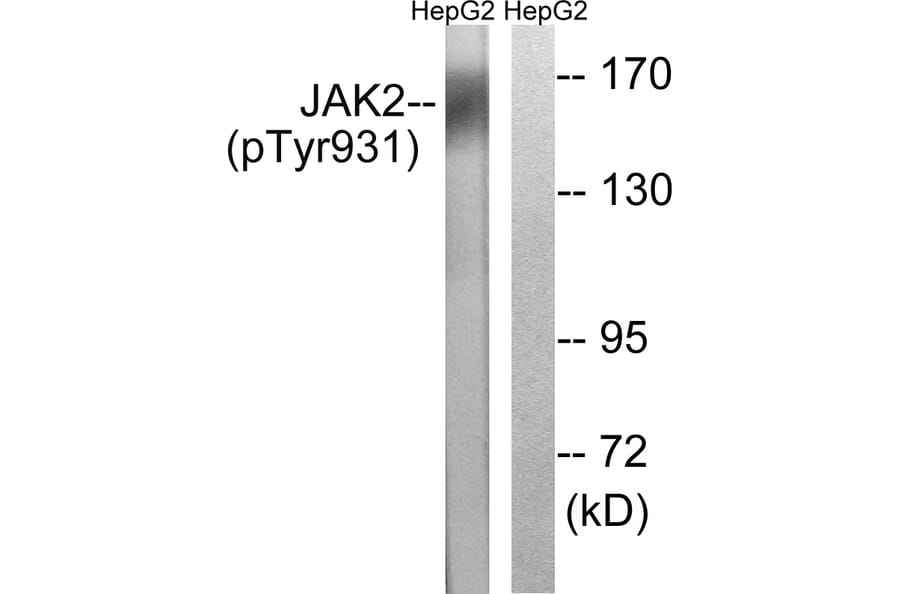 Western Blot - Anti-JAK2 (phospho Tyr931) Antibody (A8118) - Antibodies.com