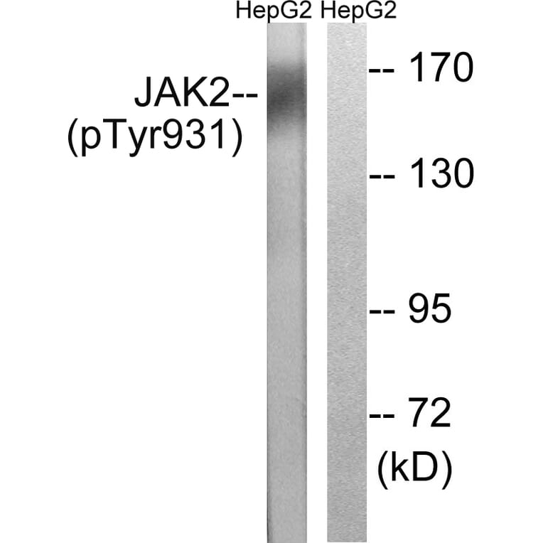 Western Blot - Anti-JAK2 (phospho Tyr931) Antibody (A8118) - Antibodies.com