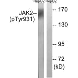 Western Blot - Anti-JAK2 (phospho Tyr931) Antibody (A8118) - Antibodies.com