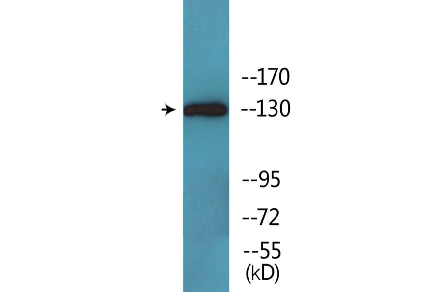 Western Blot - Anti-JAK2 (phospho Tyr931) Antibody (P12-1129) - Antibodies.com