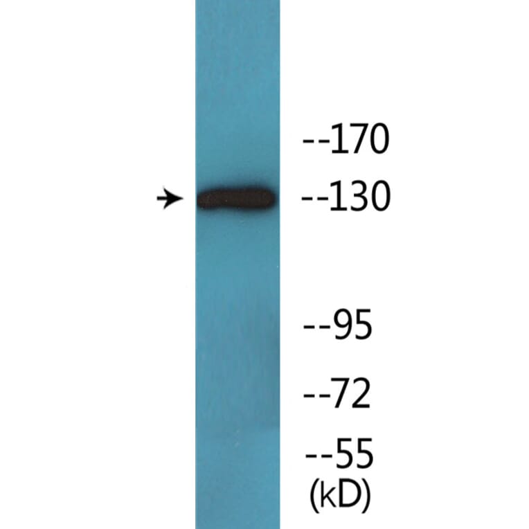 Western Blot - Anti-JAK2 (phospho Tyr931) Antibody (P12-1129) - Antibodies.com