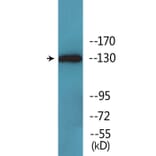 Western Blot - Anti-JAK2 (phospho Tyr931) Antibody (P12-1129) - Antibodies.com