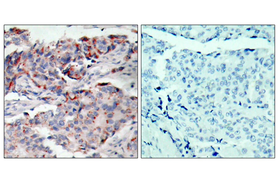 Immunohistochemistry - Anti-JAK2 (phospho Tyr221) Antibody (A7127) - Antibodies.com