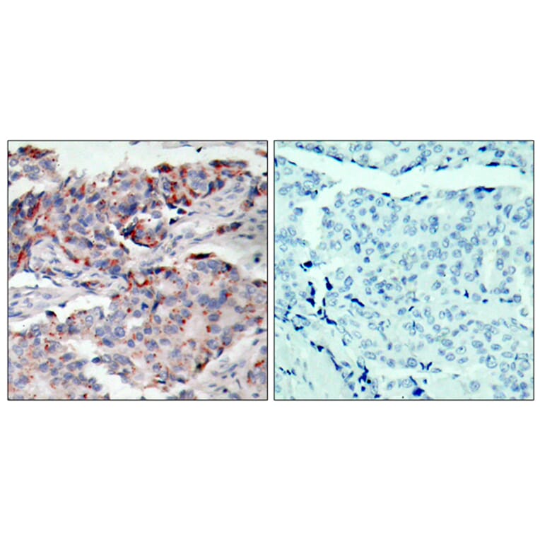 Immunohistochemistry - Anti-JAK2 (phospho Tyr221) Antibody (A7127) - Antibodies.com